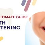 Teeth Whitening Guide